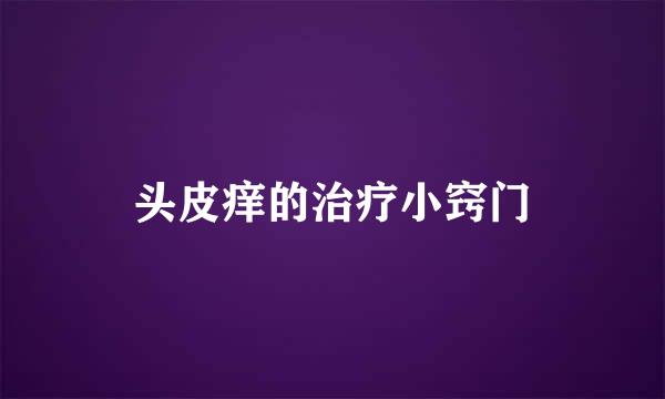 头皮痒的治疗小窍门