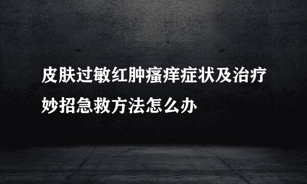 皮肤过敏红肿瘙痒症状及治疗妙招急救方法怎么办