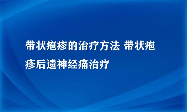 带状疱疹的治疗方法 带状疱疹后遗神经痛治疗