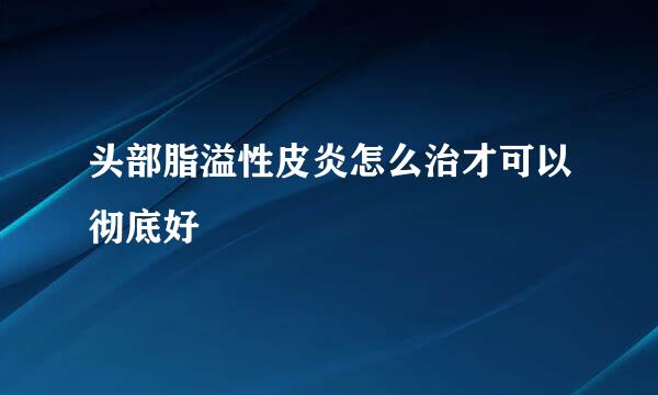 头部脂溢性皮炎怎么治才可以彻底好
