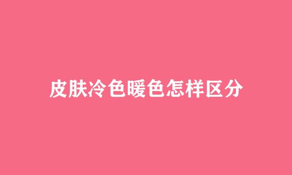 皮肤冷色暖色怎样区分