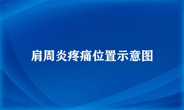 肩周炎疼痛位置示意图