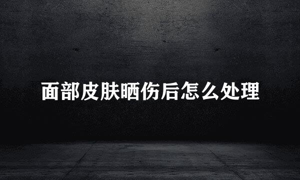 面部皮肤晒伤后怎么处理