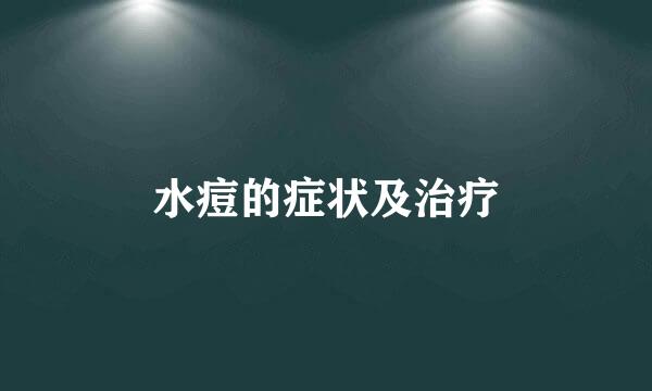 水痘的症状及治疗