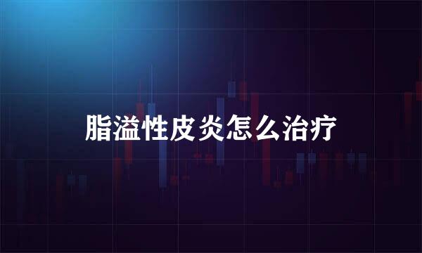 脂溢性皮炎怎么治疗