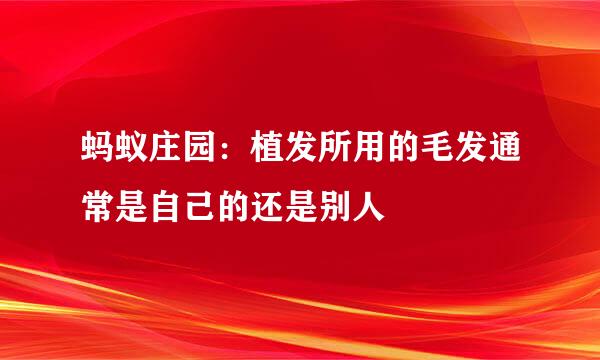 蚂蚁庄园：植发所用的毛发通常是自己的还是别人