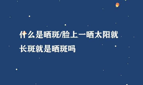 什么是晒斑/脸上一晒太阳就长斑就是晒斑吗