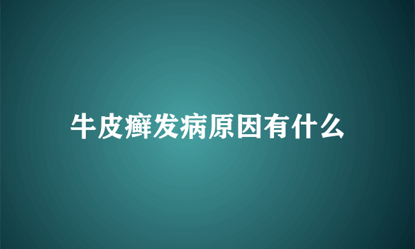 牛皮癣发病原因有什么