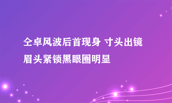 仝卓风波后首现身 寸头出镜眉头紧锁黑眼圈明显