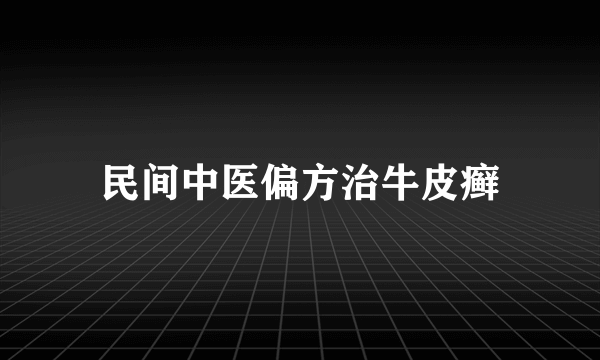 民间中医偏方治牛皮癣