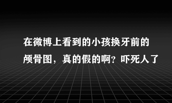 在微博上看到的小孩换牙前的颅骨图，真的假的啊？吓死人了