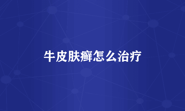 牛皮肤癣怎么治疗