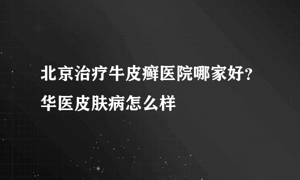 北京治疗牛皮癣医院哪家好？华医皮肤病怎么样
