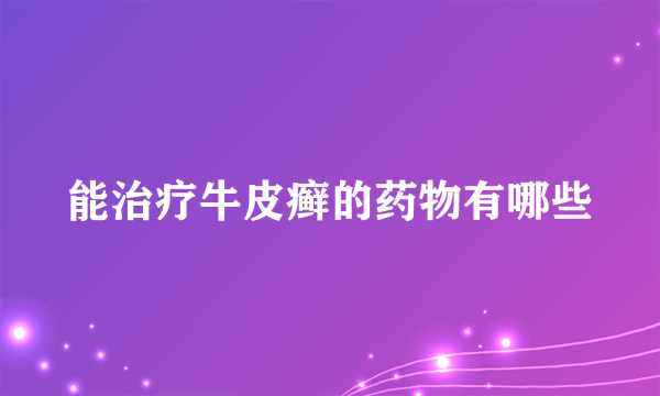 能治疗牛皮癣的药物有哪些