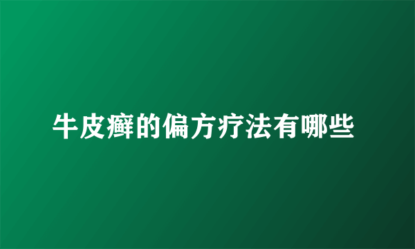 牛皮癣的偏方疗法有哪些 