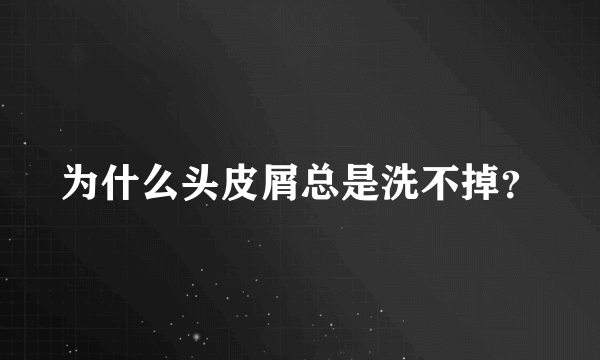 为什么头皮屑总是洗不掉？