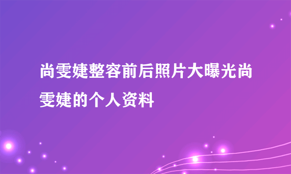 尚雯婕整容前后照片大曝光尚雯婕的个人资料