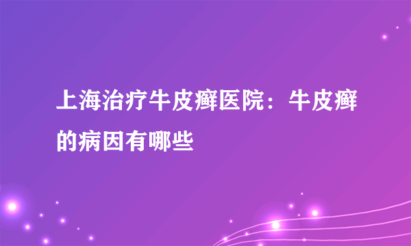 上海治疗牛皮癣医院：牛皮癣的病因有哪些