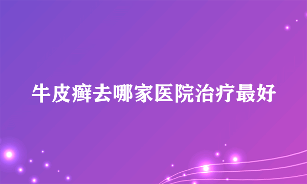 牛皮癣去哪家医院治疗最好