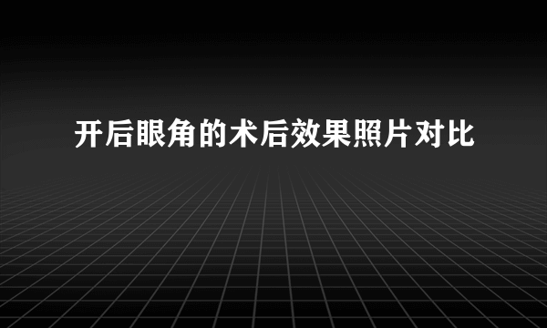 开后眼角的术后效果照片对比