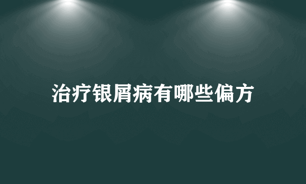 治疗银屑病有哪些偏方