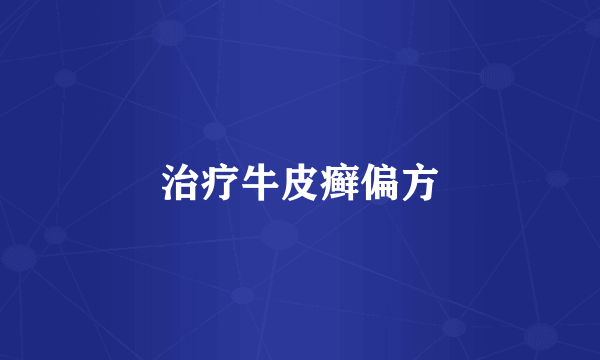 治疗牛皮癣偏方