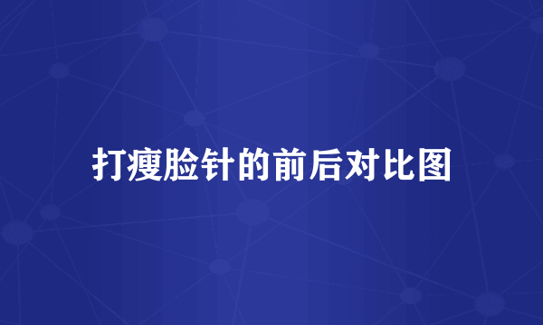 打瘦脸针的前后对比图