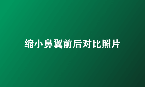 缩小鼻翼前后对比照片
