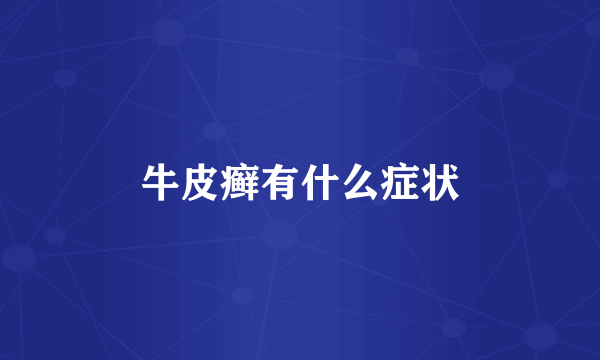 牛皮癣有什么症状