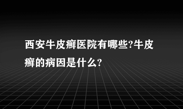 西安牛皮癣医院有哪些?牛皮癣的病因是什么?