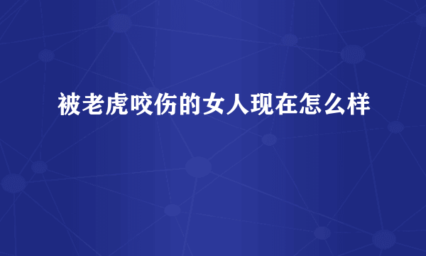 被老虎咬伤的女人现在怎么样