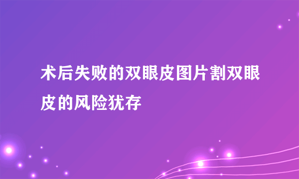 术后失败的双眼皮图片割双眼皮的风险犹存