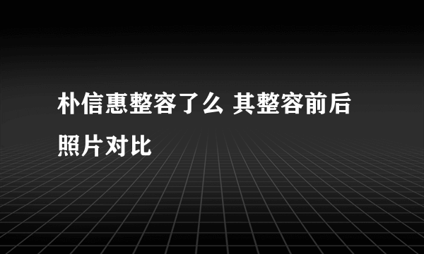 朴信惠整容了么 其整容前后照片对比