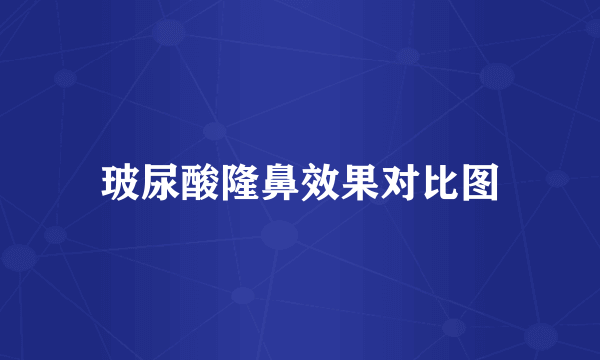 玻尿酸隆鼻效果对比图