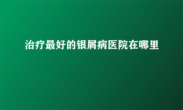 治疗最好的银屑病医院在哪里