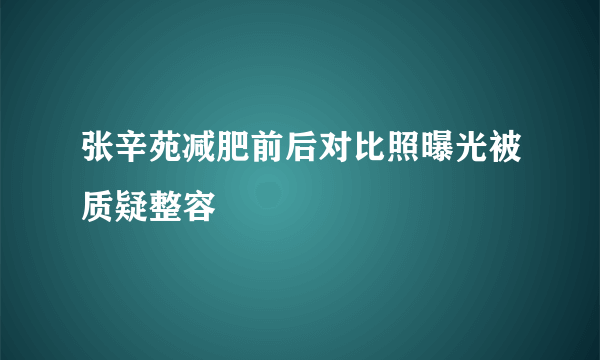 张辛苑减肥前后对比照曝光被质疑整容