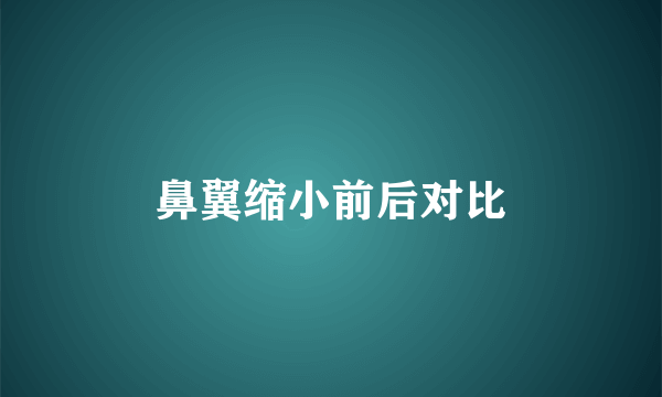 鼻翼缩小前后对比